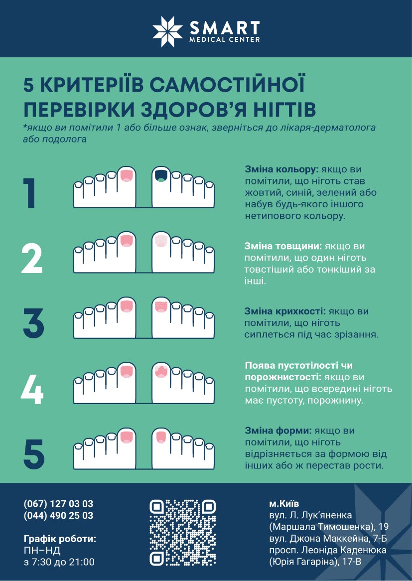 Самостійна перевірка нігтів